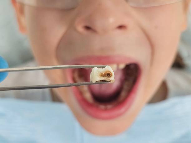 Best Emergency Dental Surgery in Germantown Hls, IL